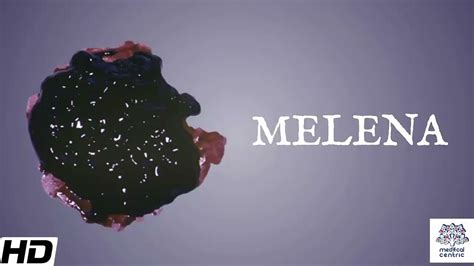 define melena|why is melena black.